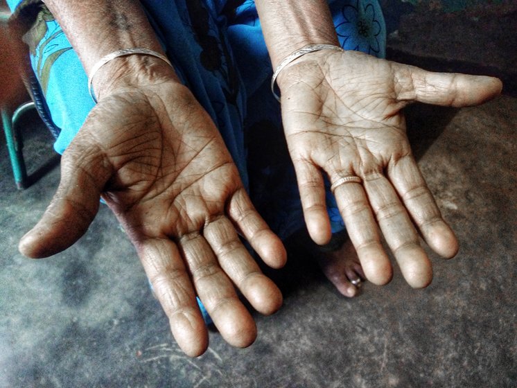 An old woman's hands