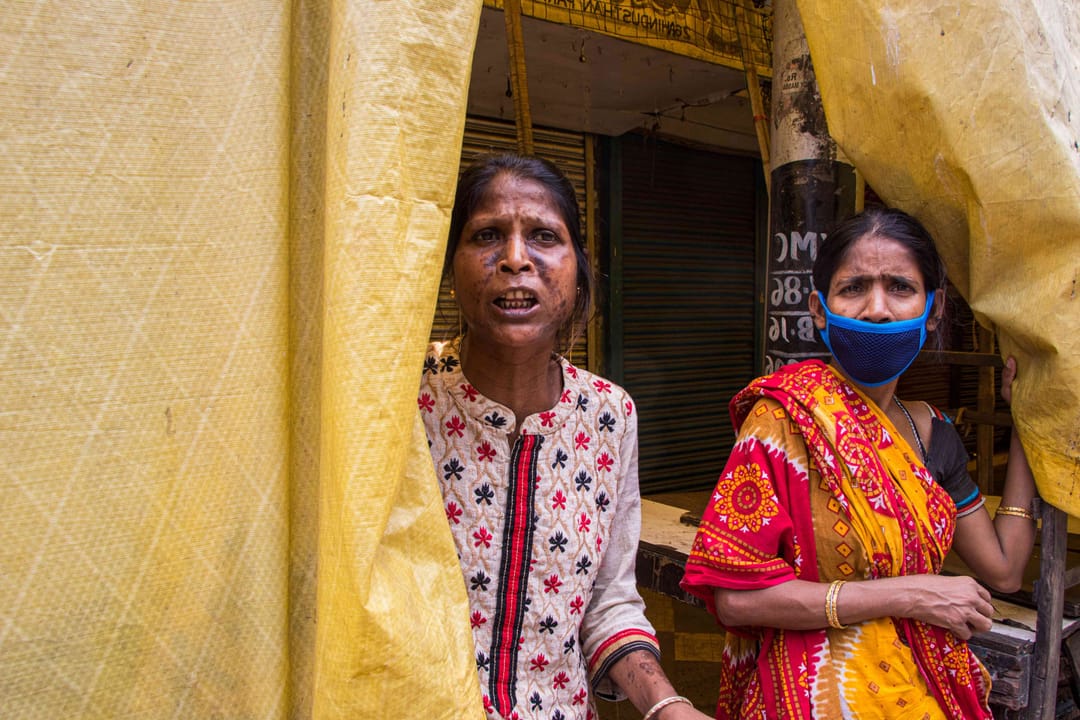 માથા પર ચક્રવાત, કોરોના અને એક માત્ર ફ્લાયઓવર