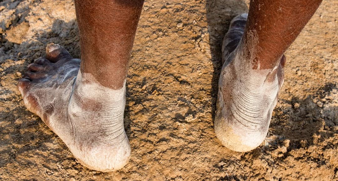 Gujarat’s agariyas – the salt of the earth