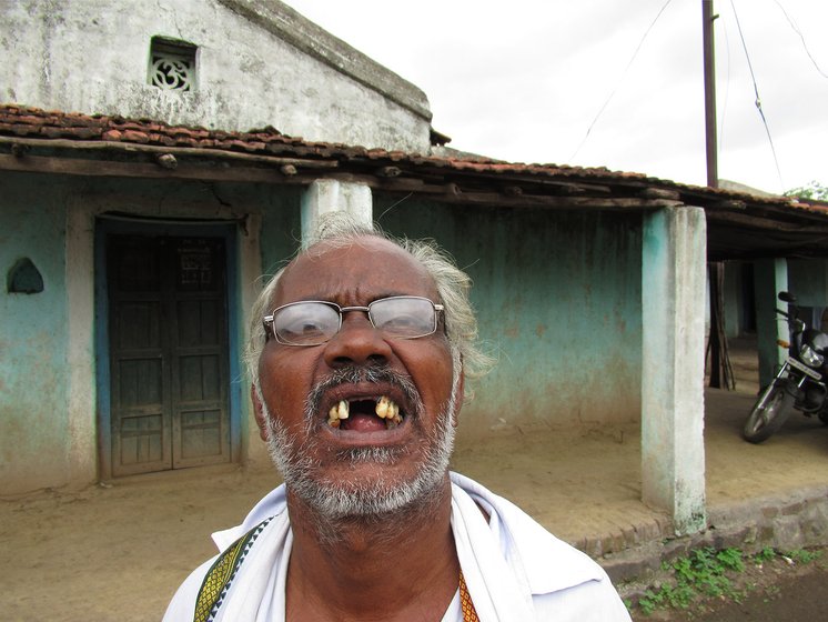 Man with his two front teeth missing