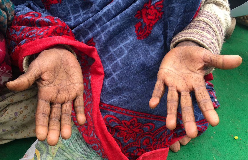 Hardeep Kaur (left), 42, is a Dalit labourer from Bhuttiwala village of Gidderbaha tehsil in Punjab’s Muktsar district. She reached the Tikri border on January 7 with other union members. “I started labouring in the fields when I was a child. Then the machines came and now I barely get work on farms," she says "I have a job card [for MGNREGA], but get that work only for 10-15 days, and our payments are delayed for months." Shanti Devi (sitting, right) a 50-year-old Dalit agricultural labourer from Lakhewali village of Muktsar district, says, “We can eat only when we have work. Where will go once these farm laws are implemented? Right: Shanti Devi’s hands
