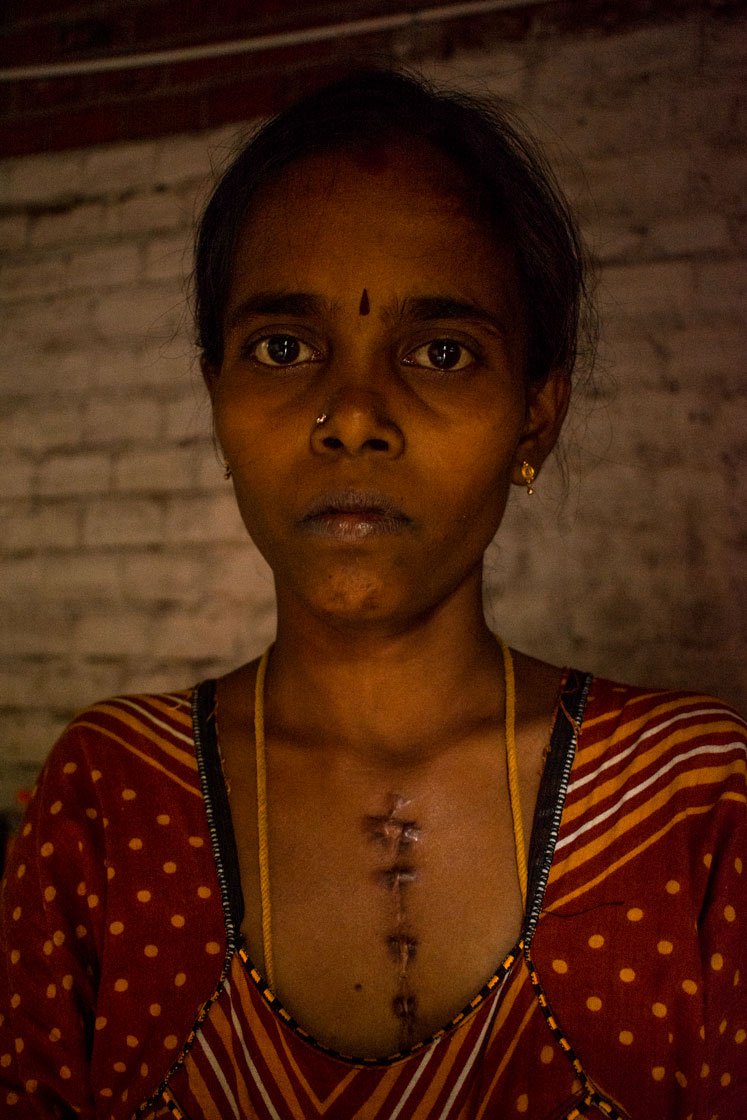 Chitra watches over her four year old son, Vishanth Raja, who was born after anxious months and prayers