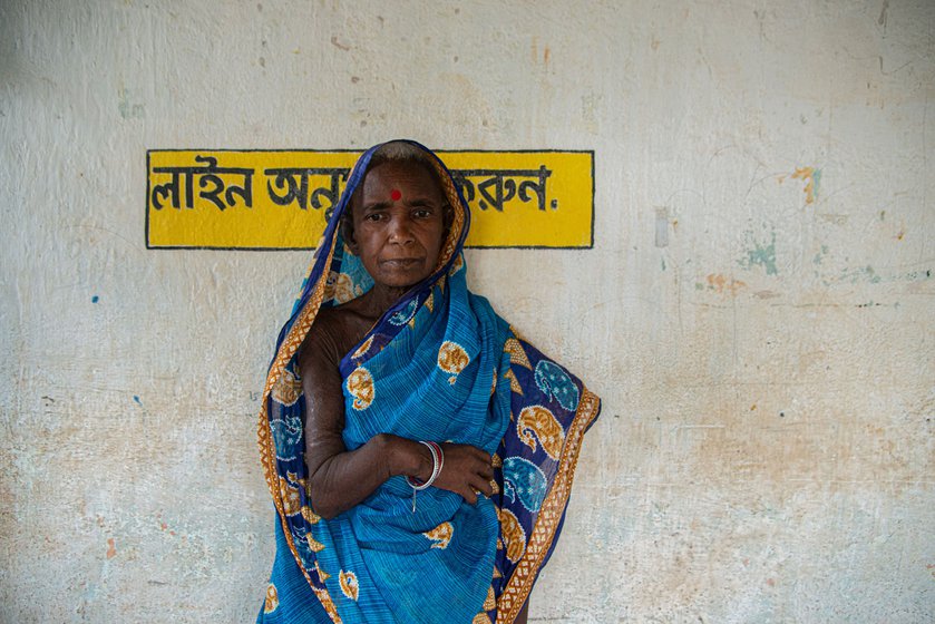 Kanak Kotal's hand (left) has become permanently deformed as she could not get medical help when she broke it. Her village, Singdhui, has little access to doctors and healthcare. Also true of Benashuli, where Kuni Bhakta (right) broke her leg, and now she is not sure when she will be able to walk again. Her husband Suben Bhakta says, they spent Rs. 8,000 on her treatment