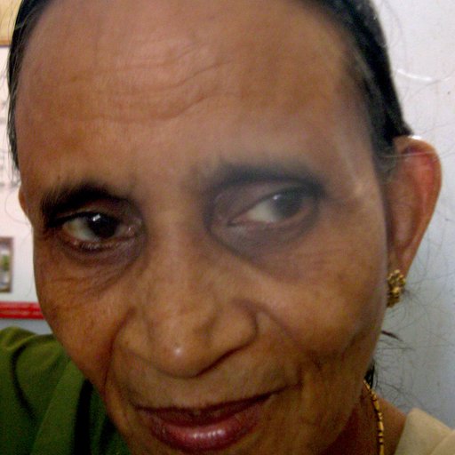 JANAMMA is a Weaver from Chadayamangalam, Chadayamangalam, Kollam, Kerala