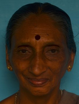 VIJAYA BALLAL